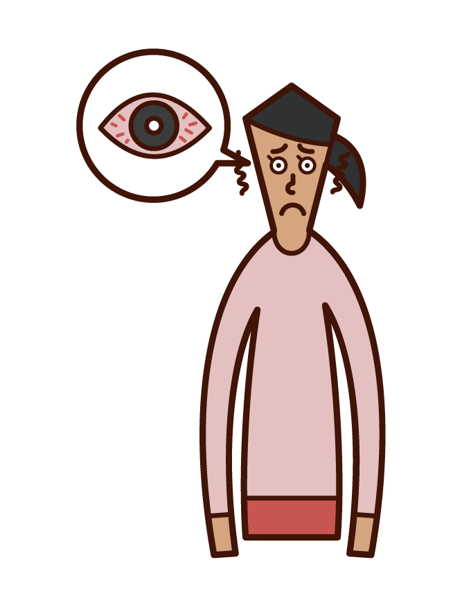 角膜炎、結膜炎和眼睛充血（女性）插圖