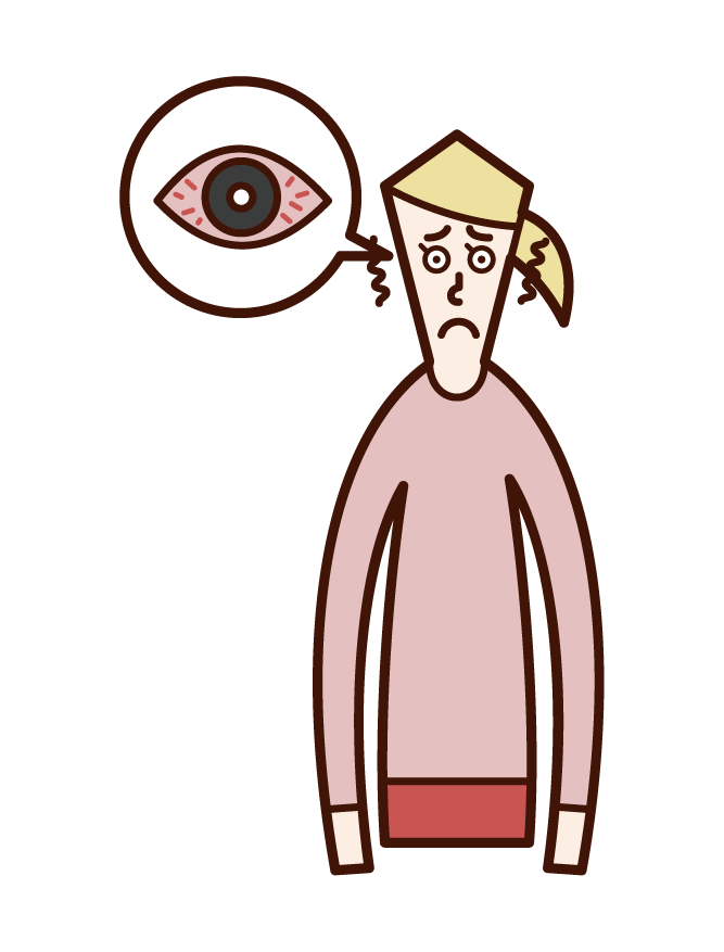 Illustration of keratitis, conjunctivitis, eye hypersediosis (woman)