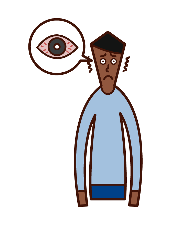 角膜炎、結膜炎和眼睛充血（男性）插圖