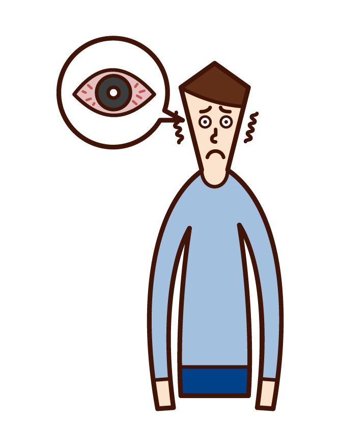 Illustration of keratitis, conjunctivitis, eye hyper hemolyses (man)