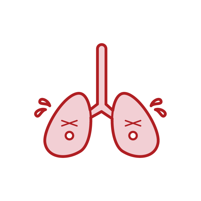 Unhealthy Lung Illustration