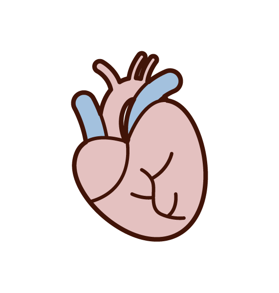 Illustration of ischemic heart disease, myocardial infarction, angina pectoris, heart failure (grandmother)