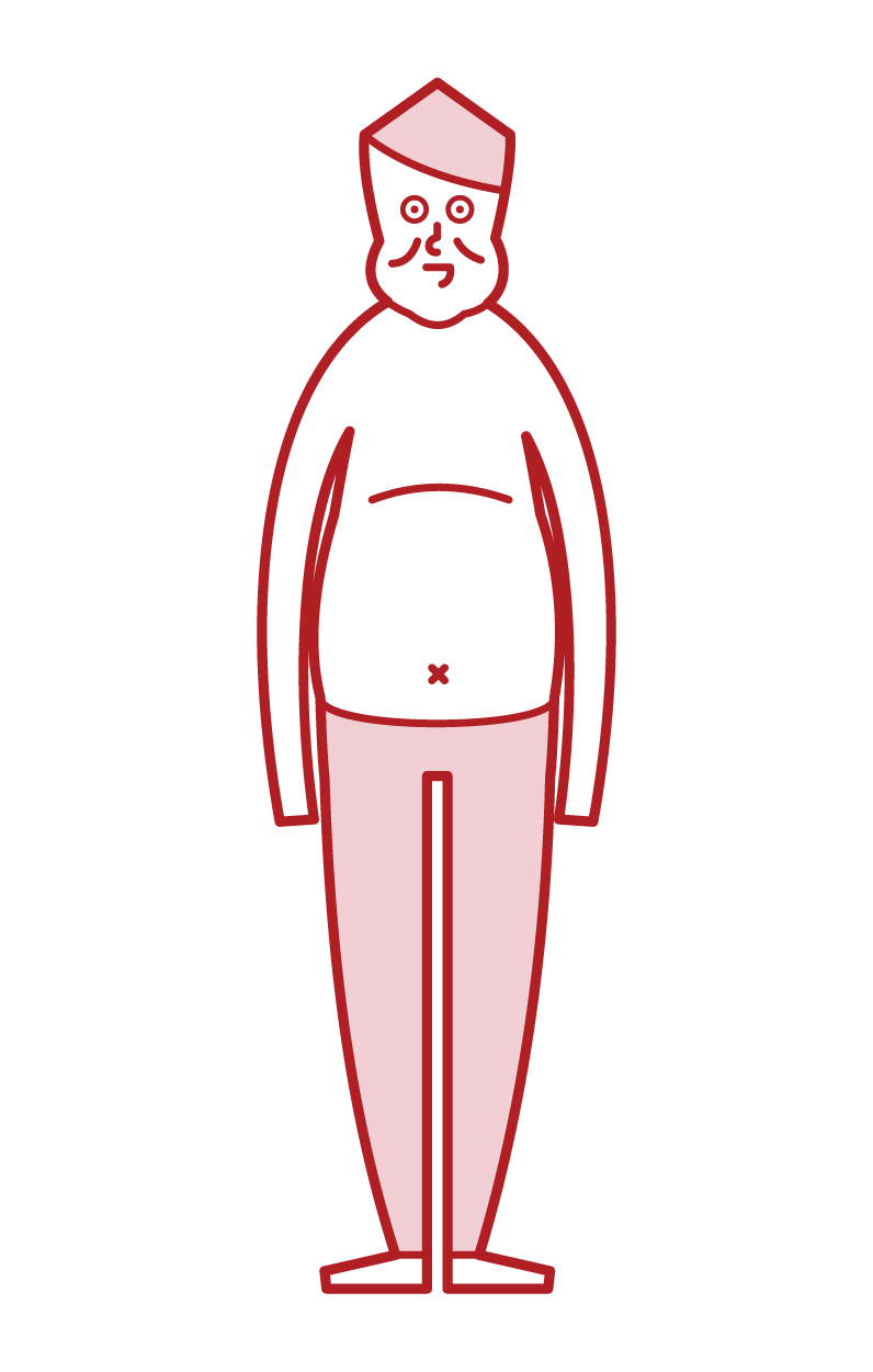 胖子、肥胖和代謝綜合征（男性）的插圖