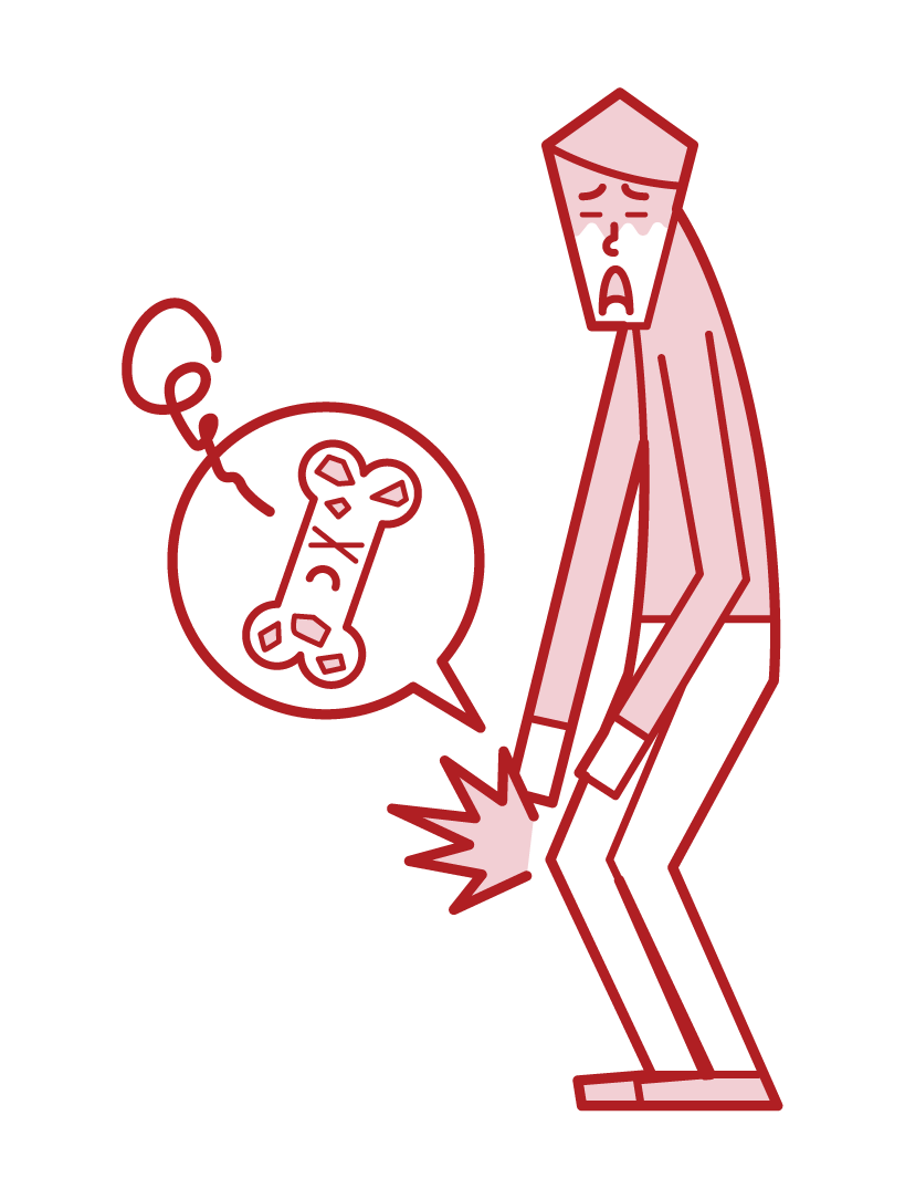 Illustration of osteoporosis (man)