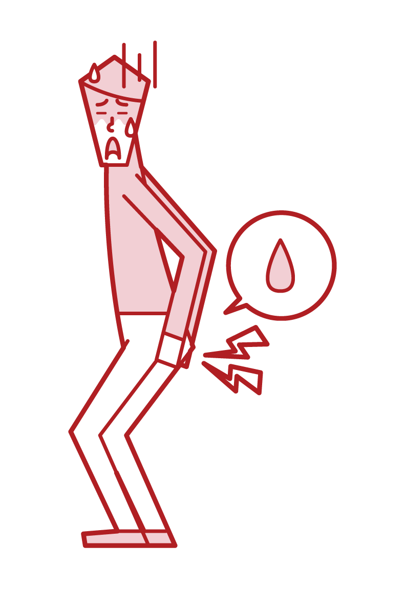 Illustration of hemorrhoids (man)