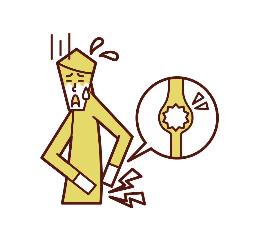 Illustration of urinary escones (man)