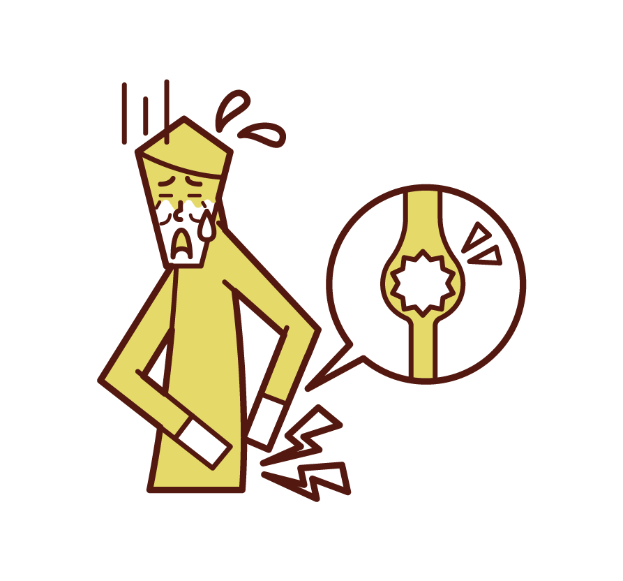 Illustration of urinary escones (man)