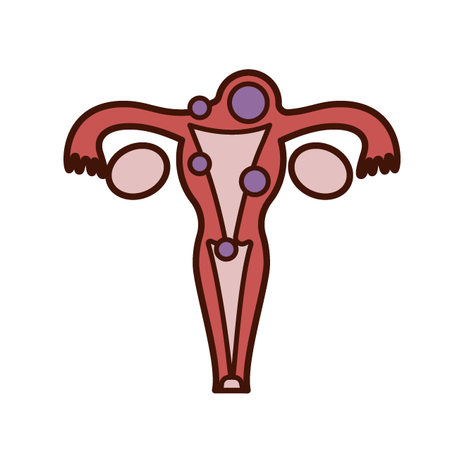 Illustration of urinary escones (man)