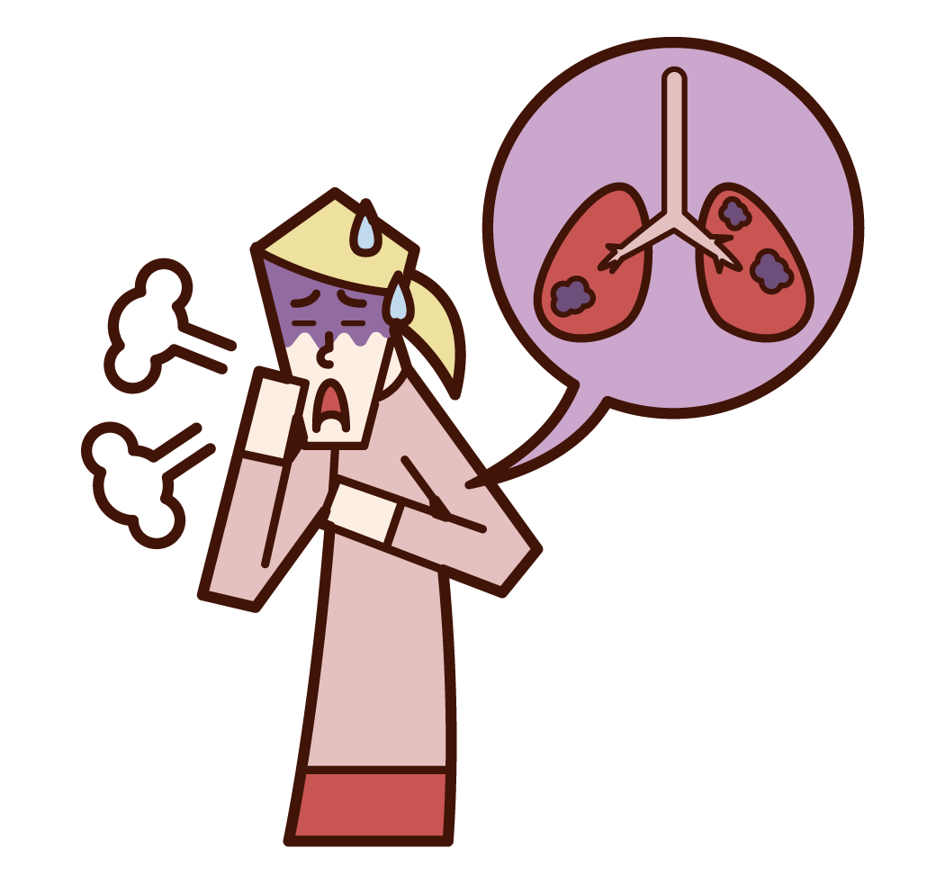 Illustration of lung cancer and lung disease (female)