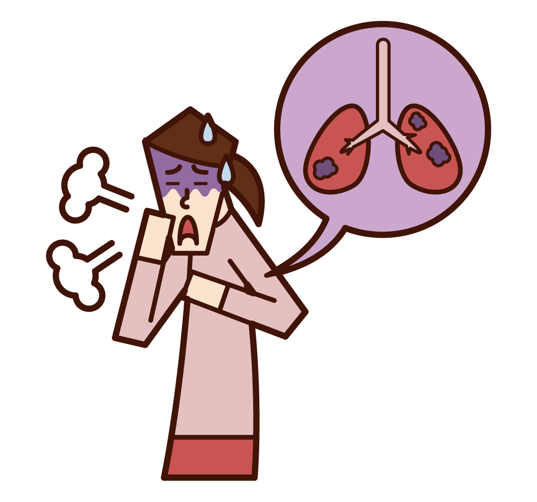 肺癌和肺病（女性）插圖