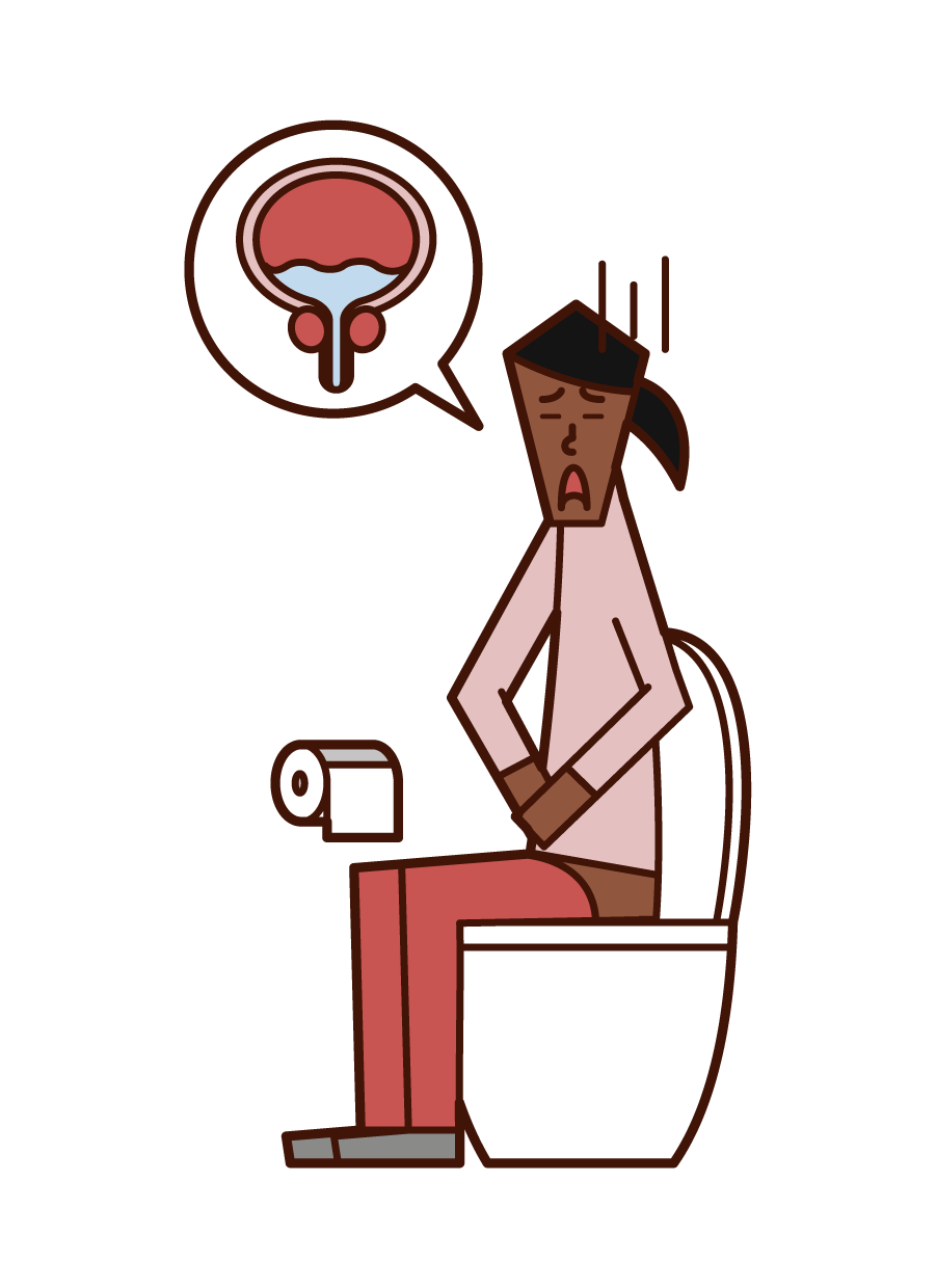 殘尿（女性）插圖