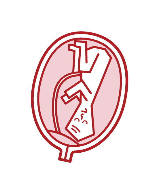 Prepositional placenta illustration