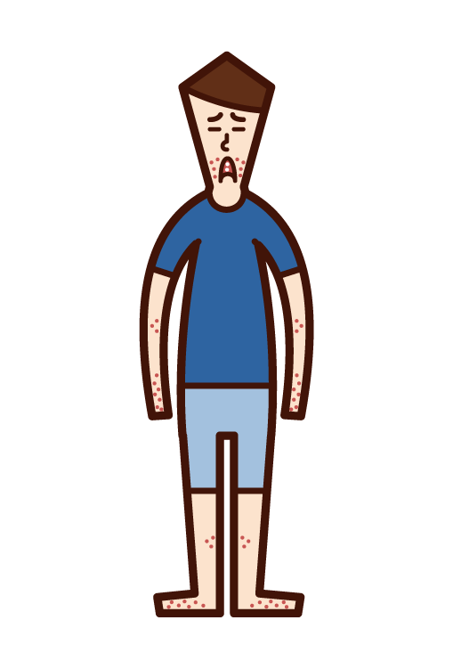 手足口病（男子）のイラスト