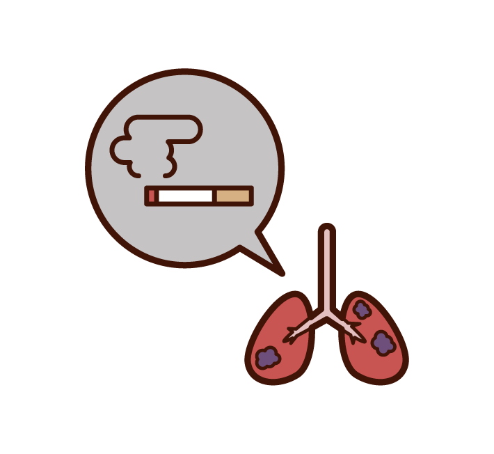 Illustration of lung cancer and lung disease