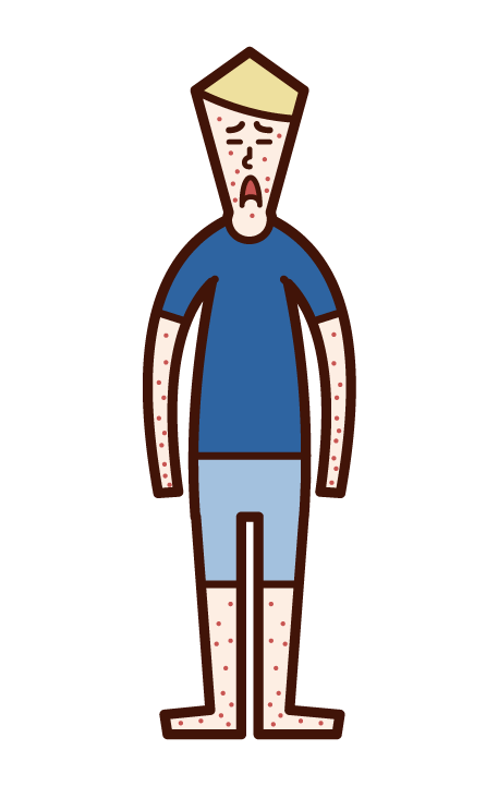 Illustration of rubella, measles, measles, eczema (boy)