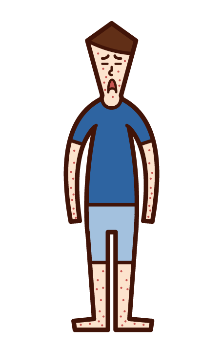 Illustration of rubella, measles, measles, eczema (boy)