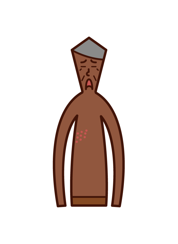 Illustration of shingles (old father)