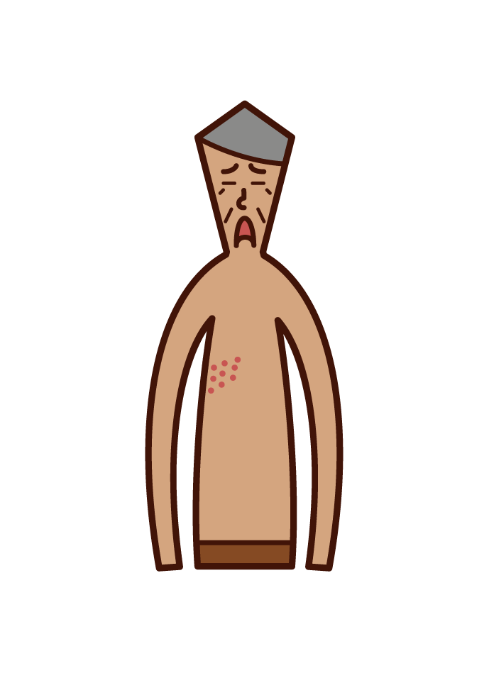 Illustration of shingles (old father)
