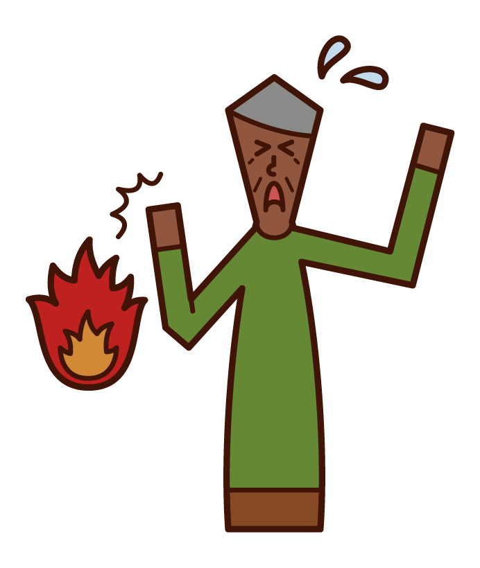 Illustration of burn (old father)