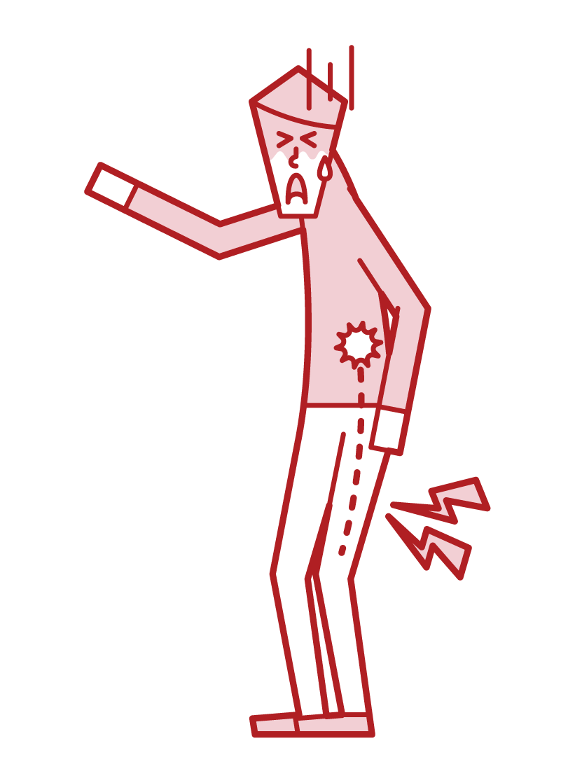 Illustration of sciatiac neuralgia and lumbar disc herniated plate (man)