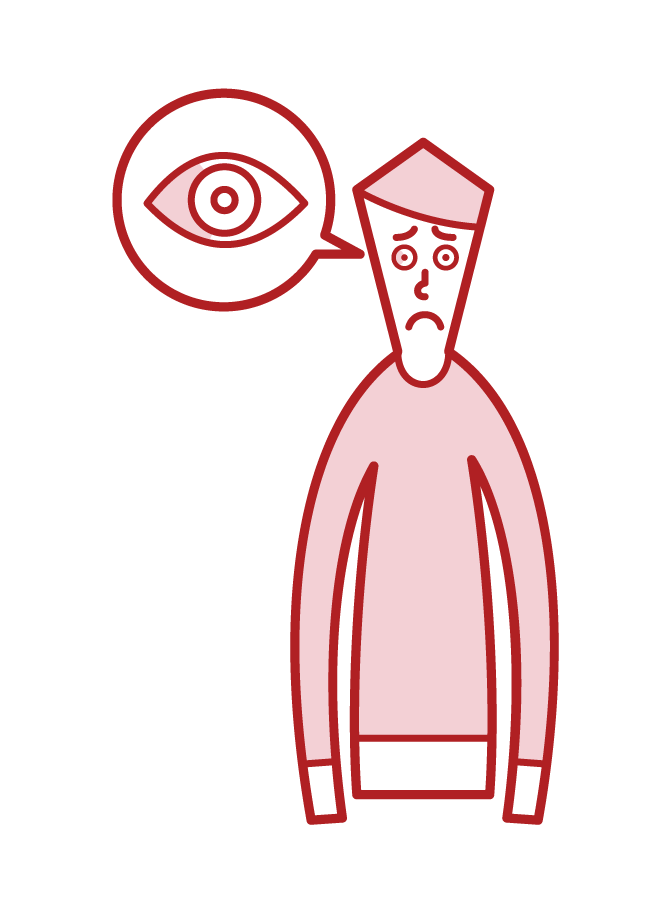 Illustration of subjunctival hemorrhage (man)