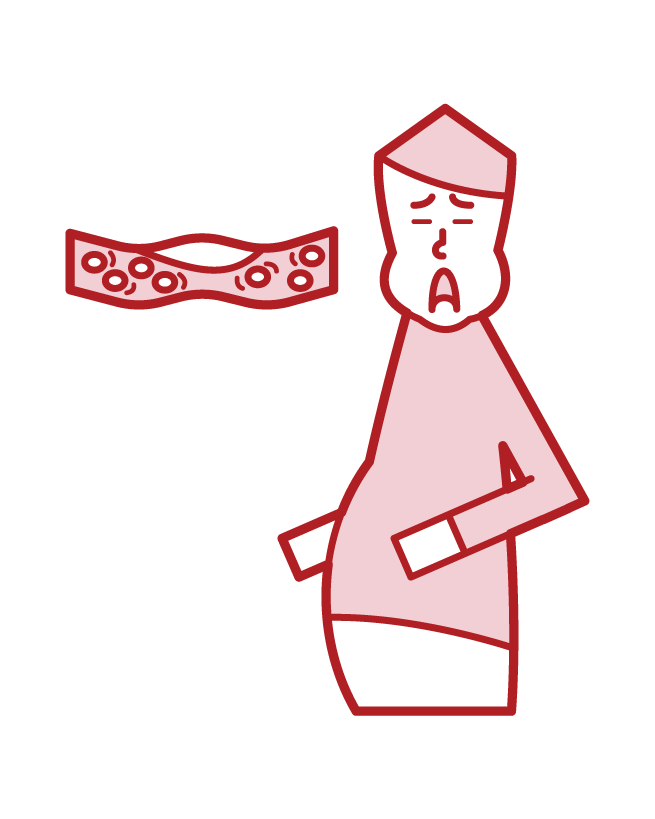 Illustration of blood (man) of dyslipidemia, hyperlipidemia, drodoro