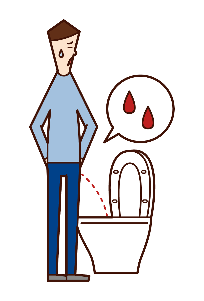 Illustration of hematuria and pyelonephritis (old man)