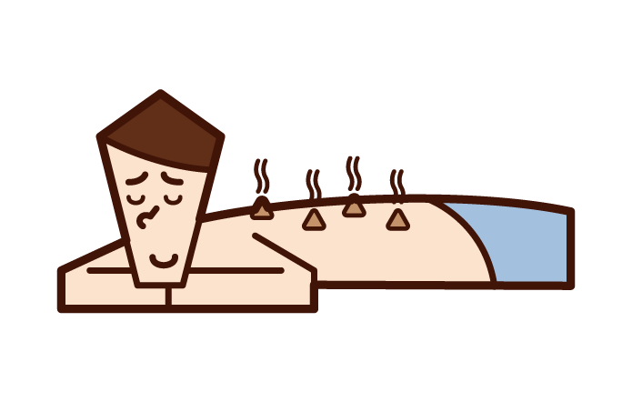 Illustration of a man receiving acupuncture