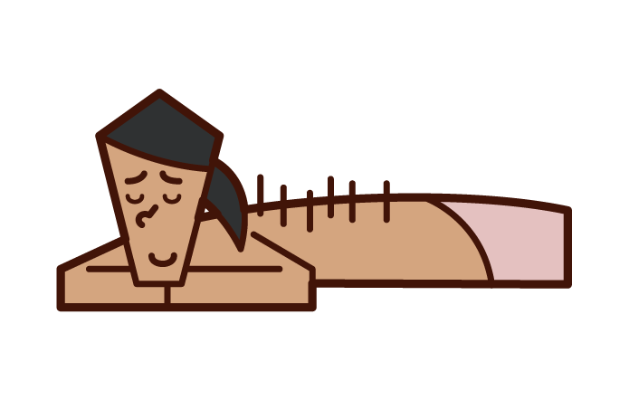 Illustration of a woman receiving acupuncture