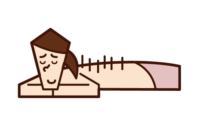 Illustration of a woman receiving acupuncture