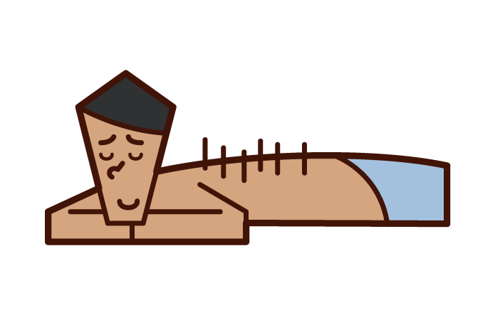Illustration of a man receiving acupuncture
